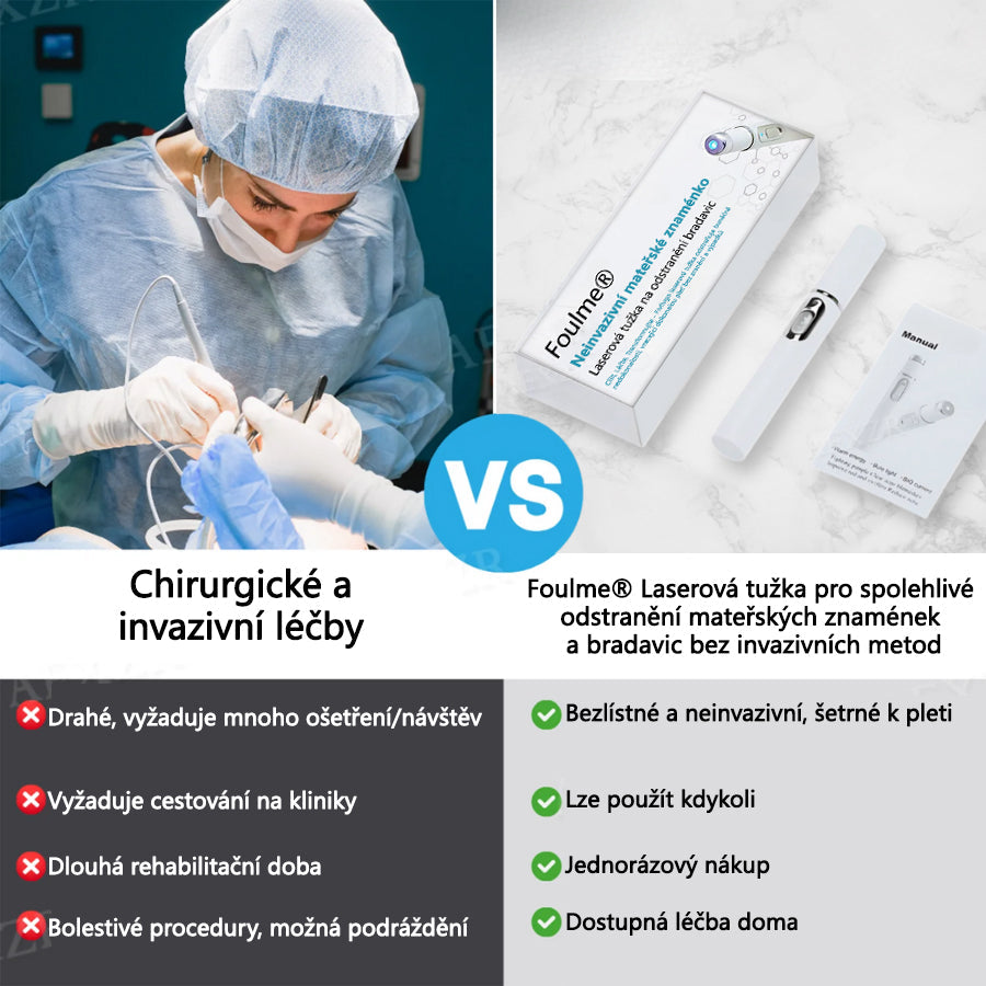 Foulme® Laserové pero na bradavice a znaménka🔦🔦 - neinvazivní a bezbolestné