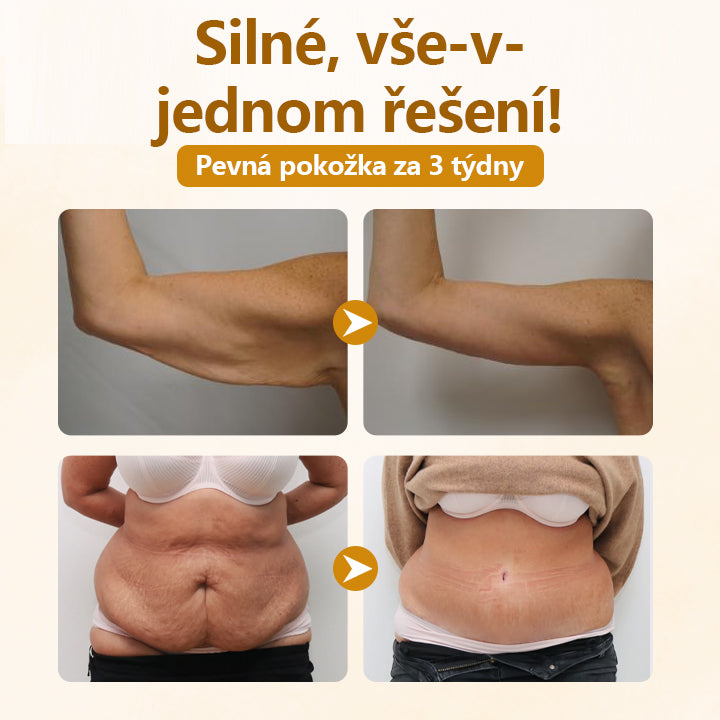Timilk® Krém na opravu s komplexem včelího jedu