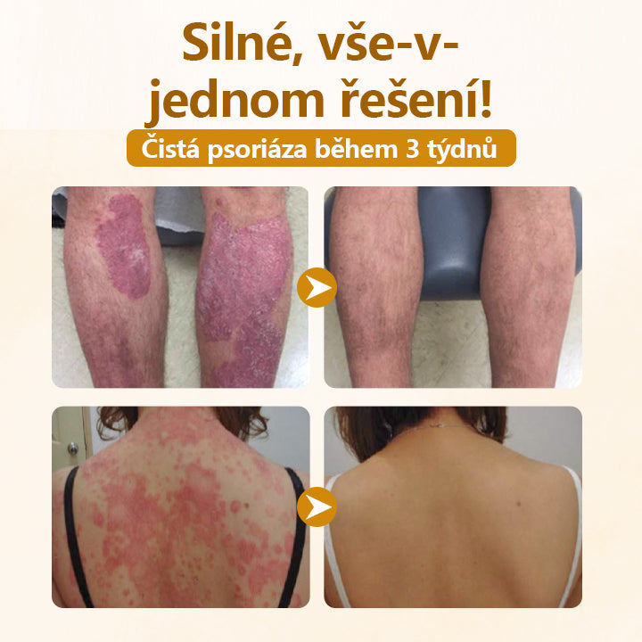 Timilk® Krém na opravu s komplexem včelího jedu