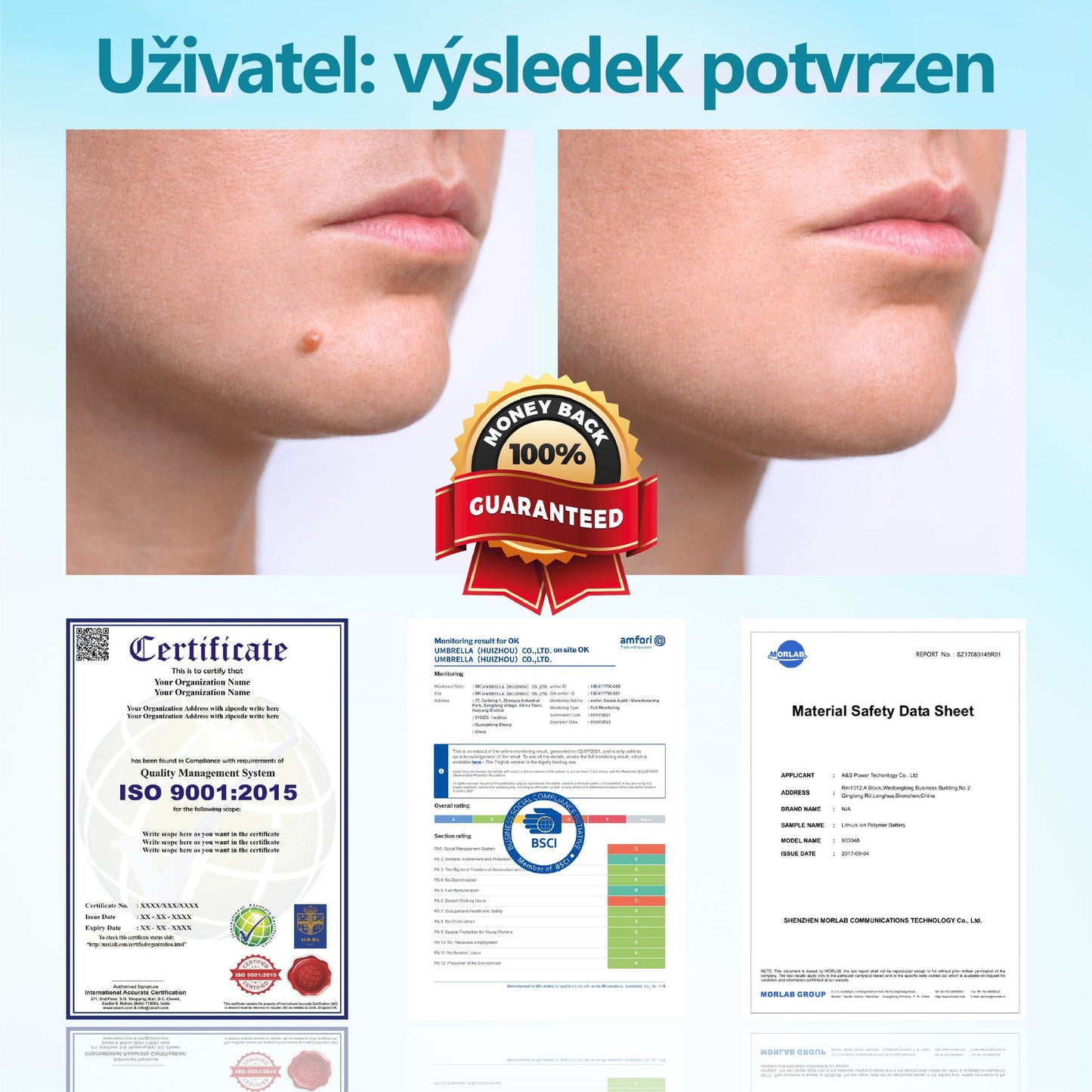 RICPIND® Laserové pero na bradavice a znaménka🔦 - neinvazivní a bezbolestné