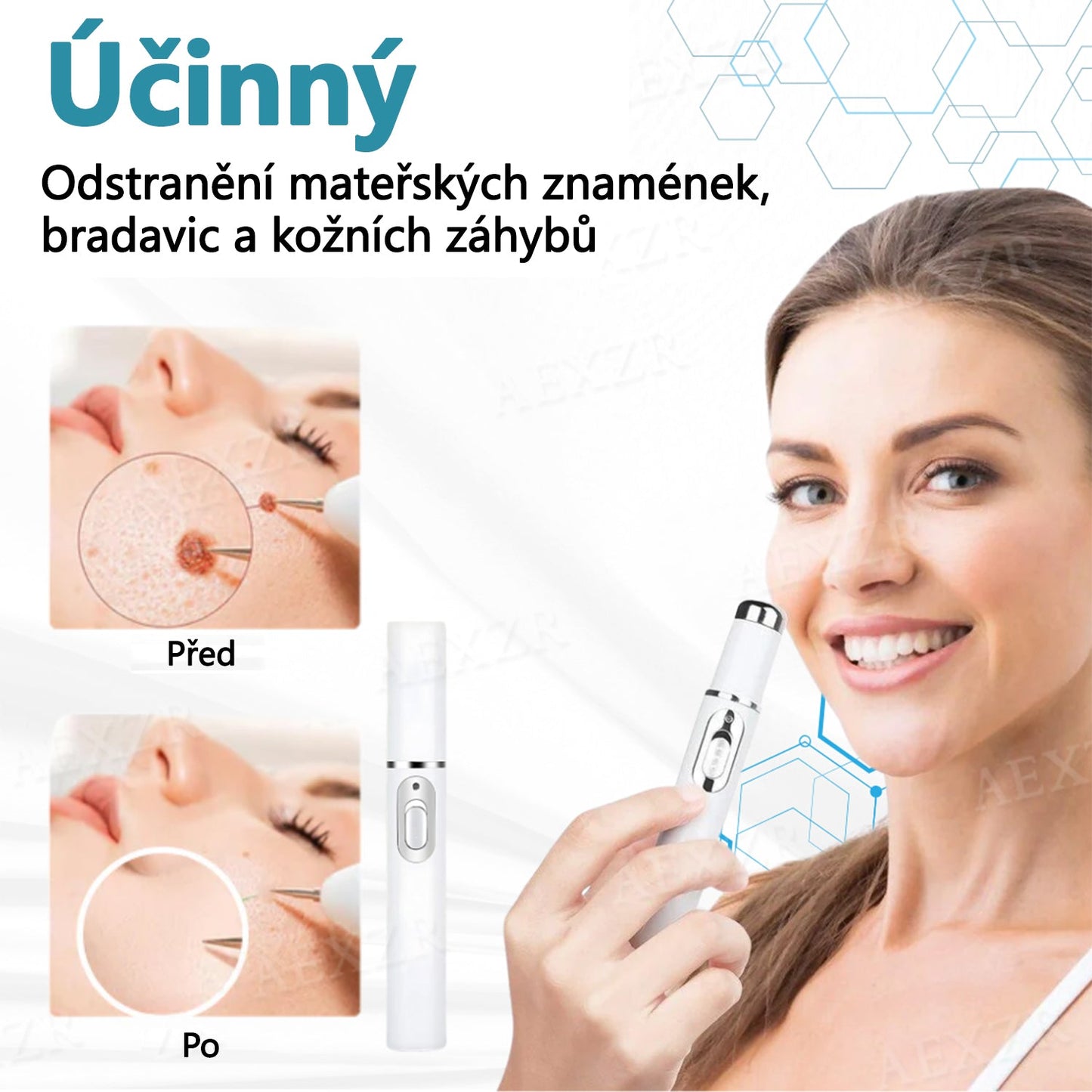 Foulme® Laserové pero na bradavice a znaménka🔦🔦 - neinvazivní a bezbolestné
