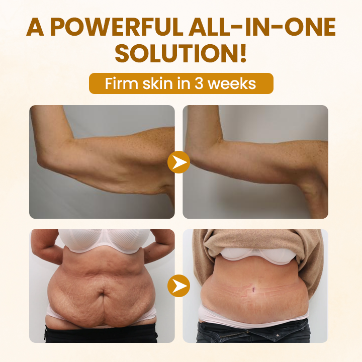 Regenerační krém Timilk® BeeVenom Complex