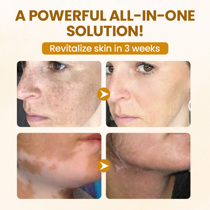 Regenerační krém Timilk® BeeVenom Complex