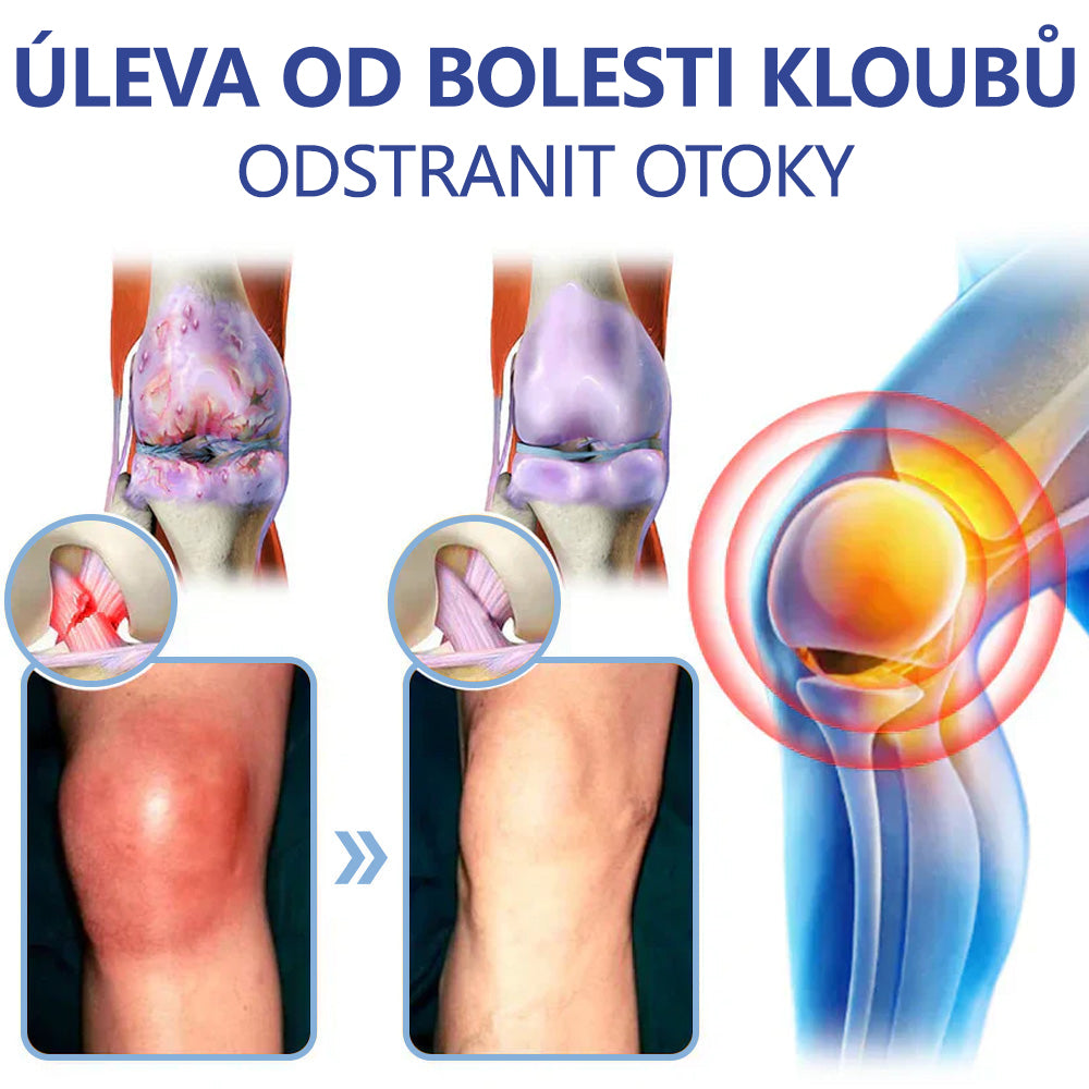 ✅ Oficiální krém s magnéziem Ourlyard® – úleva od bolesti kloubů, svalů a nervů (doporučeno Mayo Clinic)