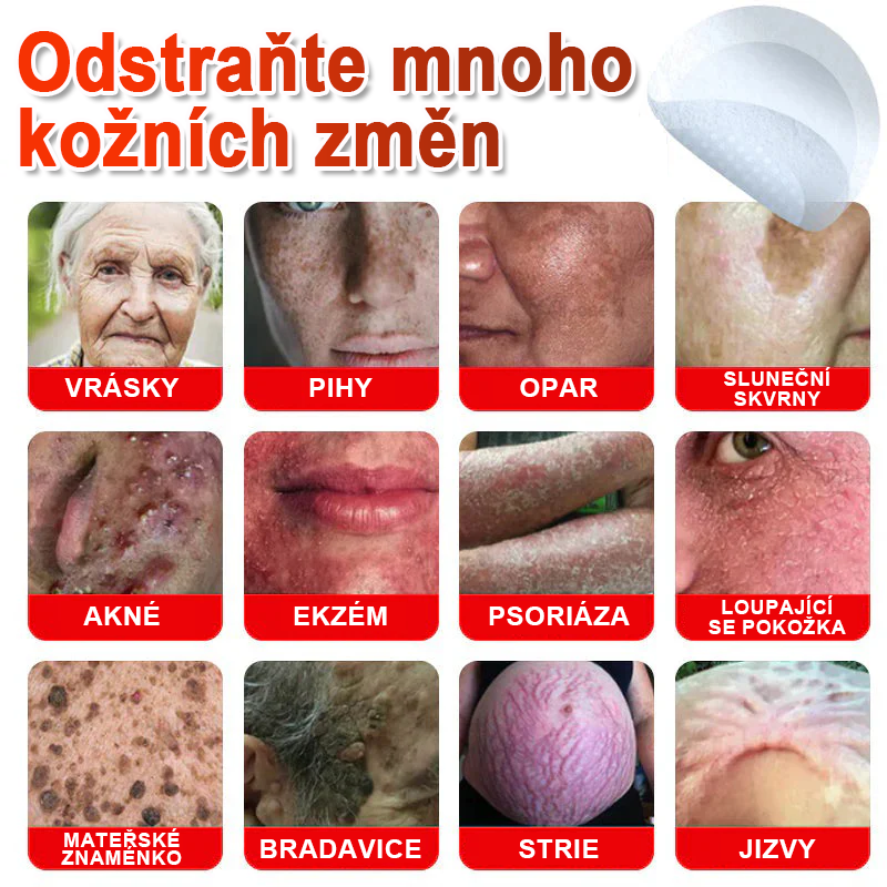 TLOPA® Mikroneedlové rostlinné náplasti na odstranění bradavic a kožních výrůstků