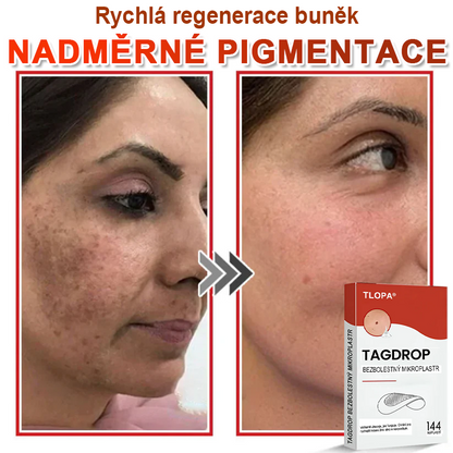 TLOPA® Mikroneedlové rostlinné náplasti na odstranění bradavic a kožních výrůstků