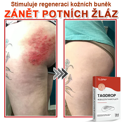 TLOPA® Mikroneedlové rostlinné náplasti na odstranění bradavic a kožních výrůstků