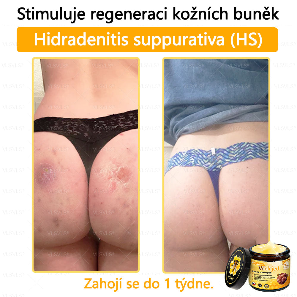 Žhavý výprodej🎉 Obnovující krém se včelím jedem🐝
