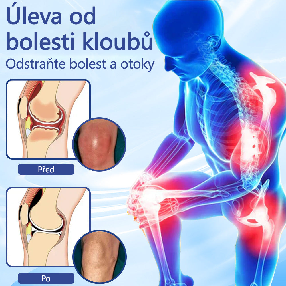 ✅ Oficiální krém s magnéziem Ourlyard® – úleva od bolesti kloubů, svalů a nervů (doporučeno Mayo Clinic)