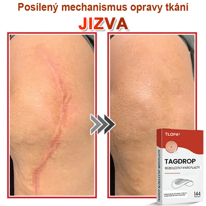 TLOPA® Mikroneedlové rostlinné náplasti na odstranění bradavic a kožních výrůstků