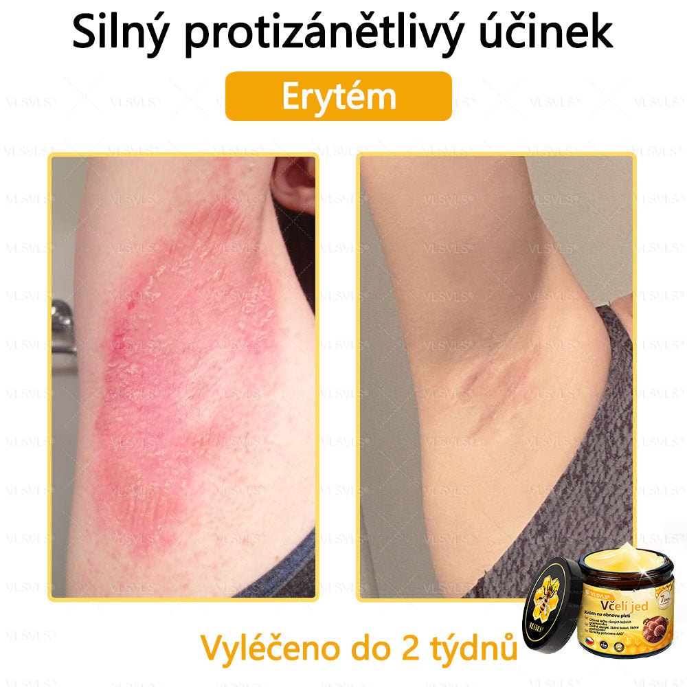 Žhavý výprodej🎉 Obnovující krém se včelím jedem🐝