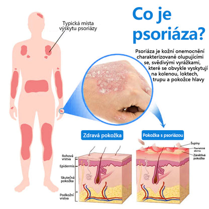 ✅Zvoevo® Magnesium bylinný sprej ⚕️ Certifikace MHRA – úleva při psoriáze, ekzému, intimních bakteriálních infekcích, akné a tmavých skvrnách✨