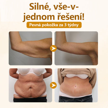 Timilk® Krém na opravu s komplexem včelího jedu