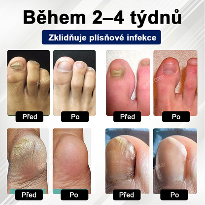 ATTDX® Fungiclear Sprej na nehty s včelí terapií✨✨