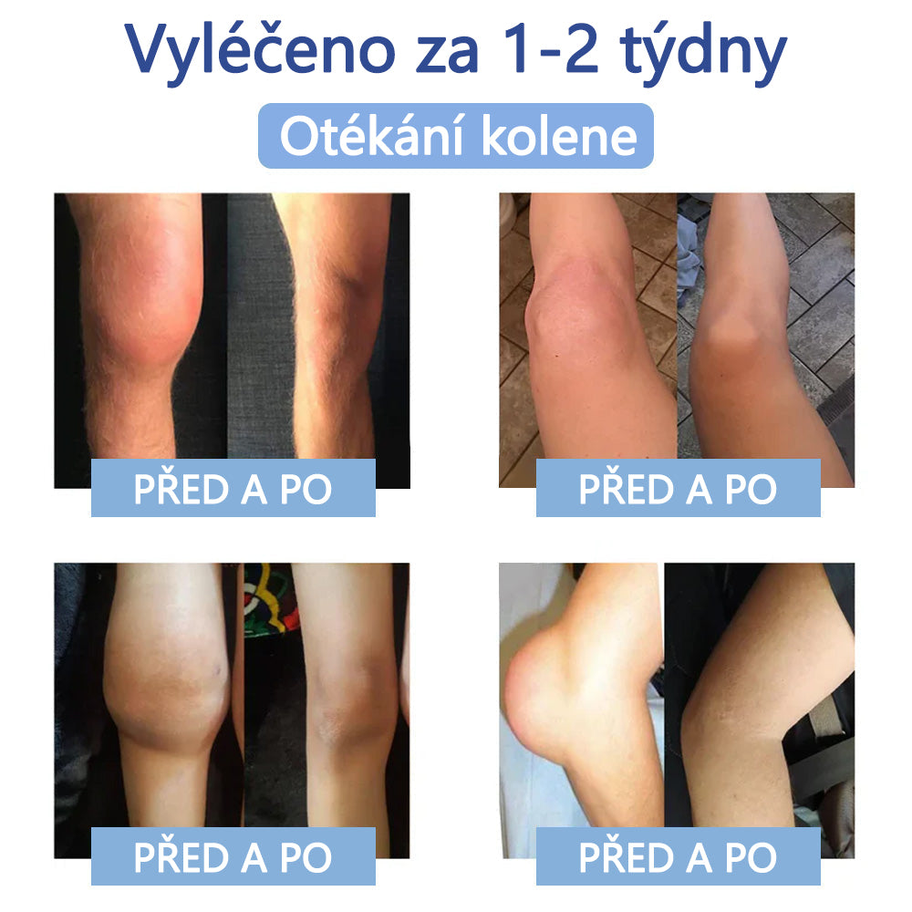 ✅ Oficiální krém s magnéziem Ourlyard® – úleva od bolesti kloubů, svalů a nervů (doporučeno Mayo Clinic)