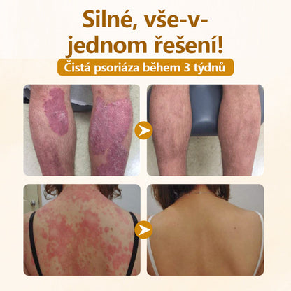 Timilk® Krém na opravu s komplexem včelího jedu