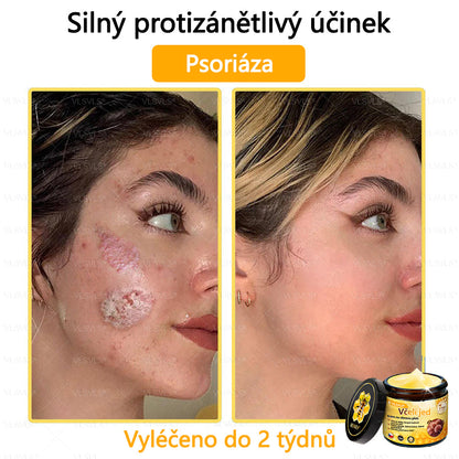 Žhavý výprodej🎉 Obnovující krém se včelím jedem🐝