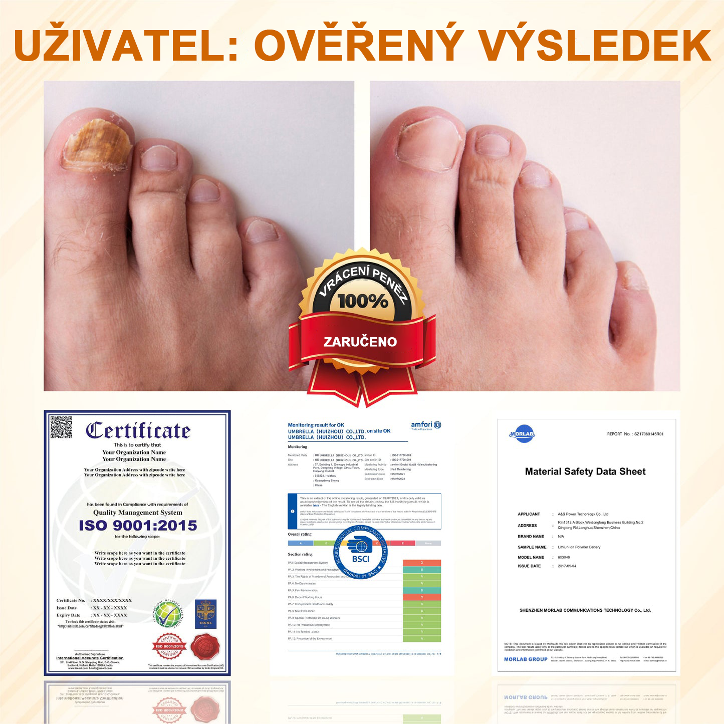 ATTDX® Fungiclear Sprej na nehty s včelí terapií✨✨