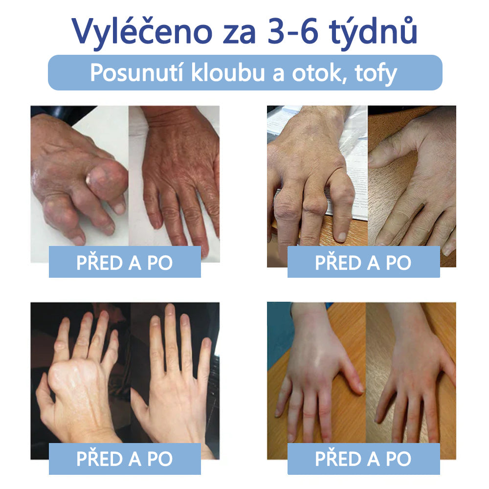 ✅ Oficiální krém s magnéziem Ourlyard® – úleva od bolesti kloubů, svalů a nervů (doporučeno Mayo Clinic)