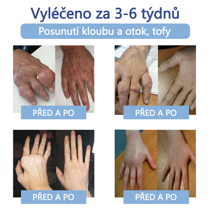 ✅ Oficiální krém s magnéziem Ourlyard® – úleva od bolesti kloubů, svalů a nervů (doporučeno Mayo Clinic)