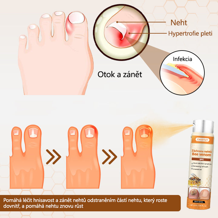 Časově omezená propagace🎉🎉 Záchrana nehtů Včelí jed ve spreji