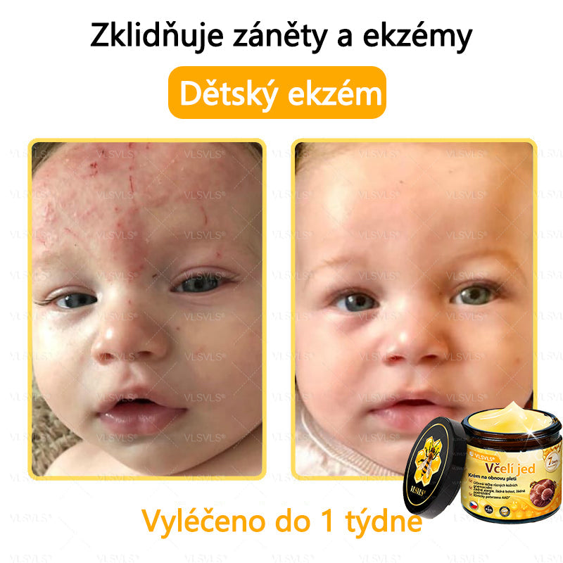 Žhavý výprodej🎉 Obnovující krém se včelím jedem🐝