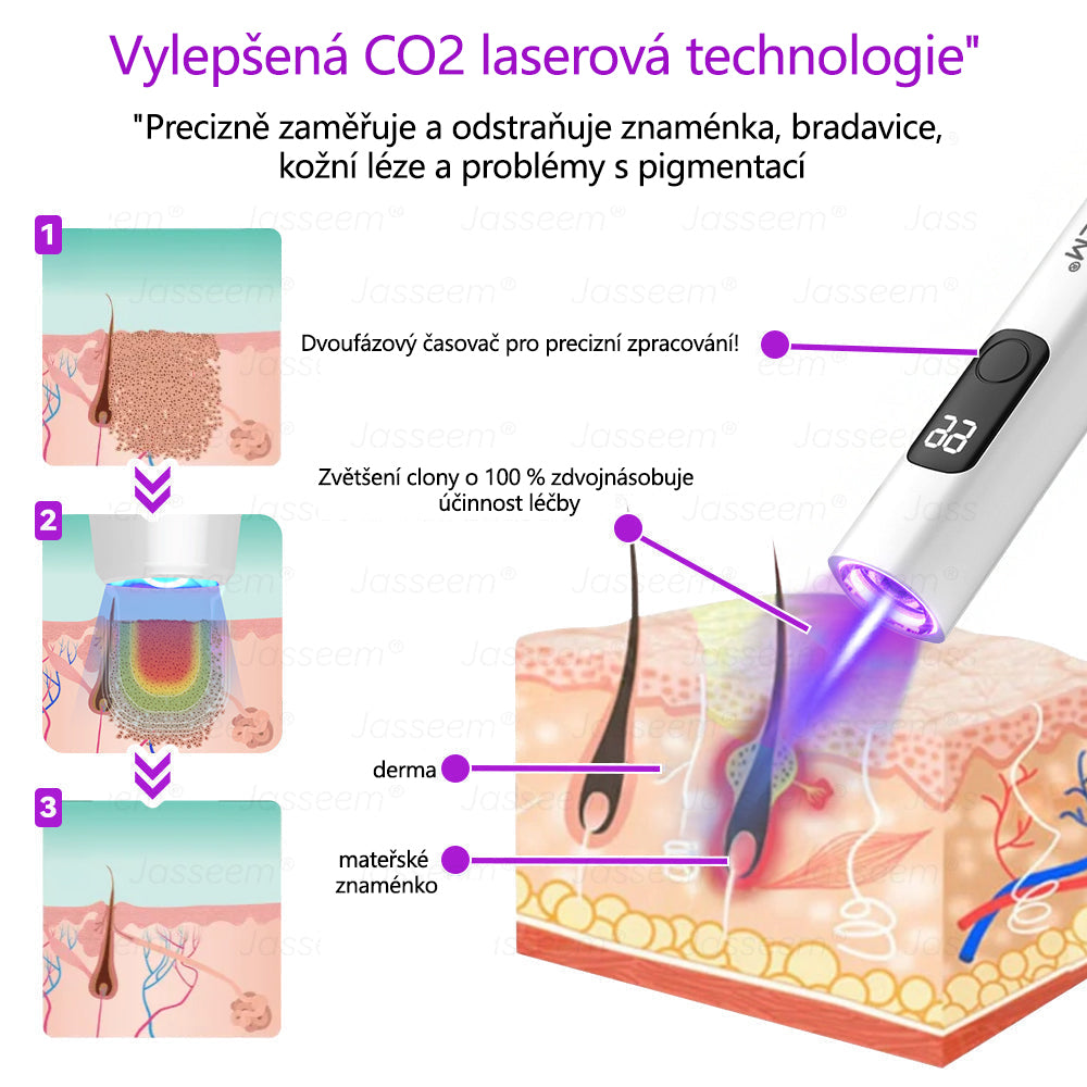 Jasseem® Pokročilá neinvazivní CO₂ laserová tužka pro obnovu pleti 🔦🔦 (Šetrně odstraňuje bradavice, pigmentové skvrny, stařecké skvrny a kožní výrůstky – bez bolesti a komplikací!)