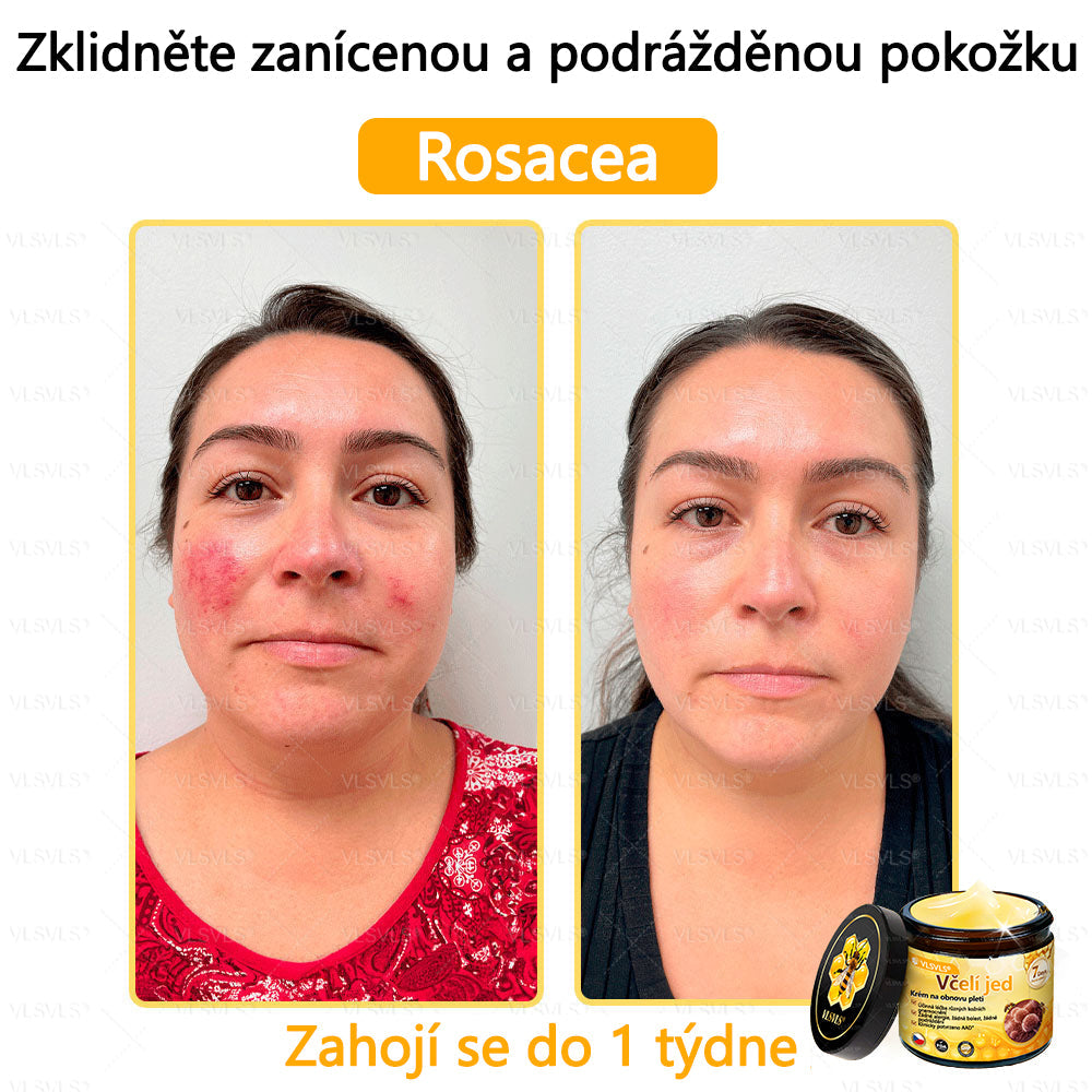 Žhavý výprodej🎉 Obnovující krém se včelím jedem🐝