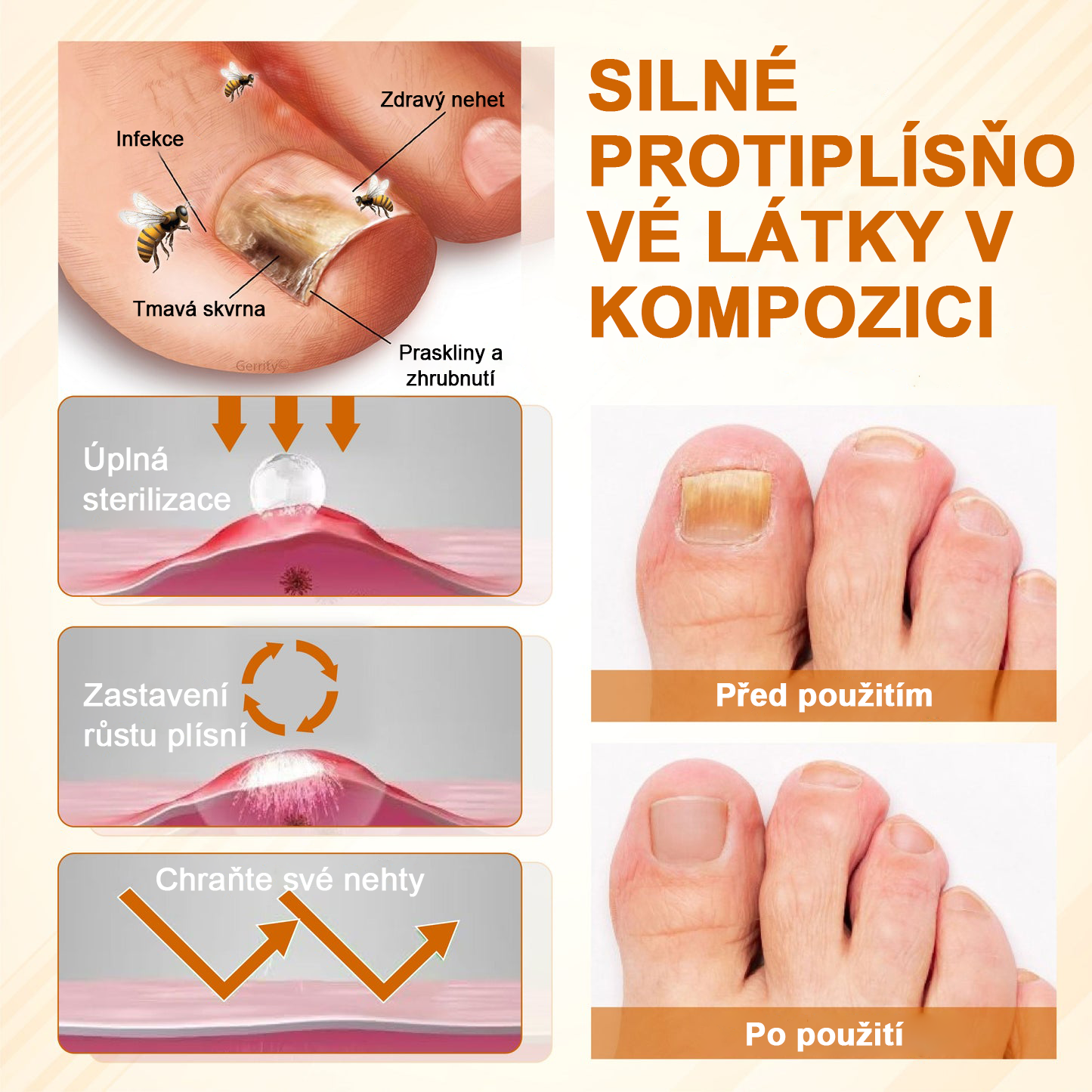 ATTDX® Fungiclear Sprej na nehty s včelí terapií✨✨