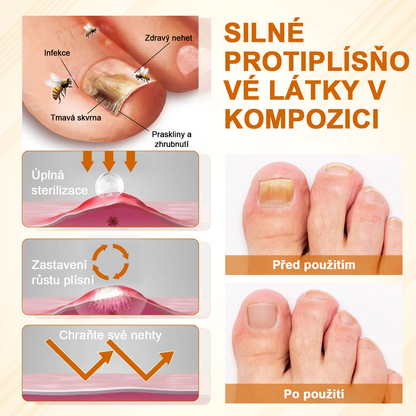 ATTDX® Fungiclear Sprej na nehty s včelí terapií✨✨