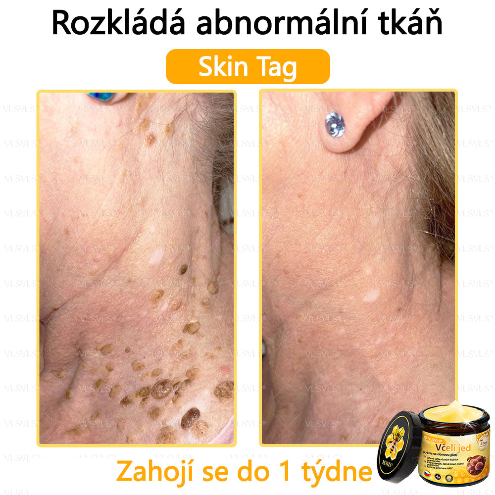 Žhavý výprodej🎉 Obnovující krém se včelím jedem🐝