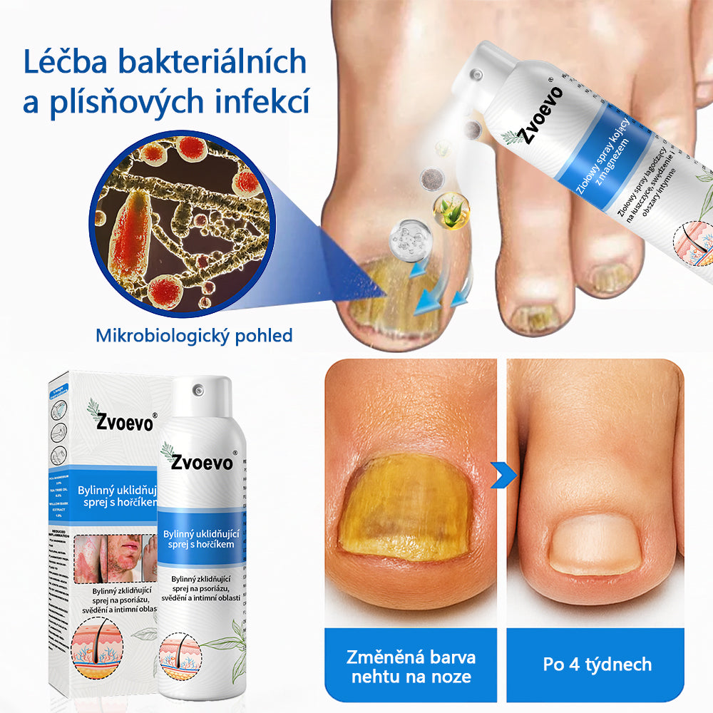✅Zvoevo® Magnesium bylinný sprej ⚕️ Certifikace MHRA – úleva při psoriáze, ekzému, intimních bakteriálních infekcích, akné a tmavých skvrnách✨