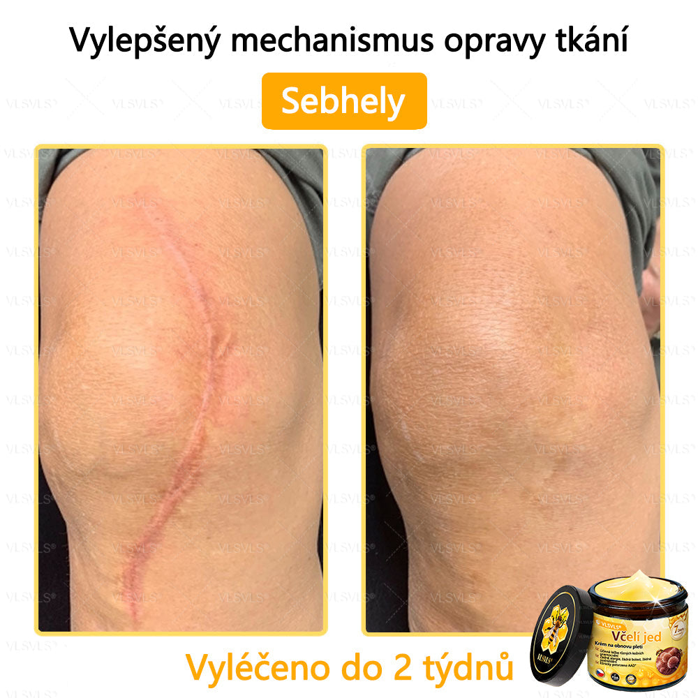 Žhavý výprodej🎉 Obnovující krém se včelím jedem🐝