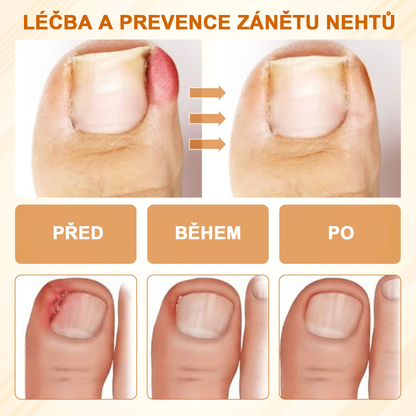 ATTDX® Fungiclear Sprej na nehty s včelí terapií✨✨