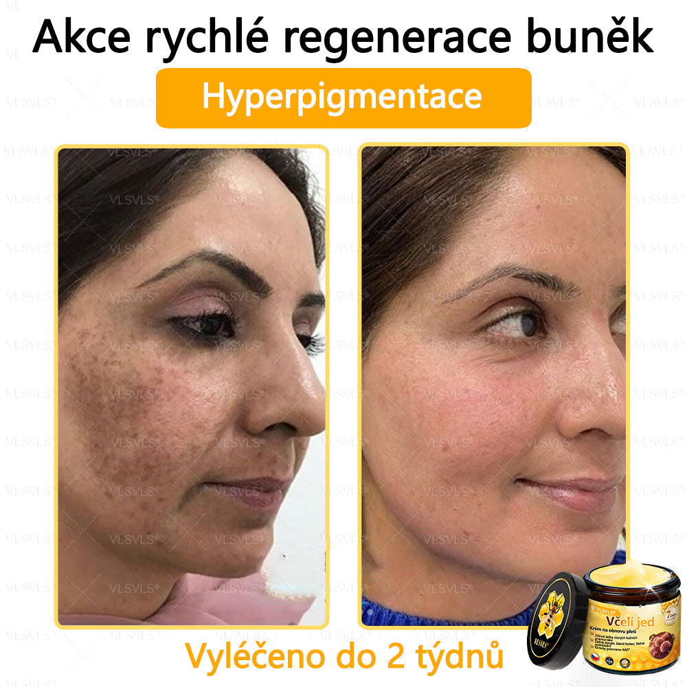Žhavý výprodej🎉 Obnovující krém se včelím jedem🐝