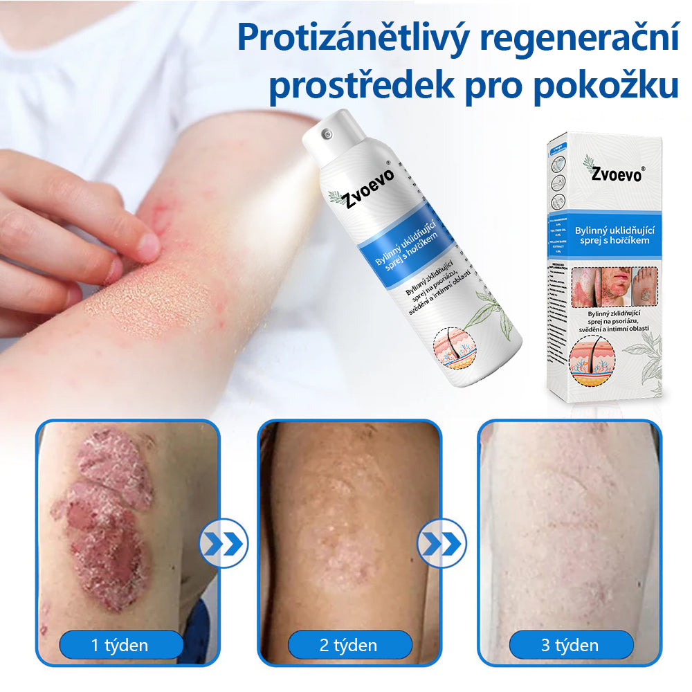 ✅Zvoevo® Magnesium bylinný sprej ⚕️ Certifikace MHRA – úleva při psoriáze, ekzému, intimních bakteriálních infekcích, akné a tmavých skvrnách✨