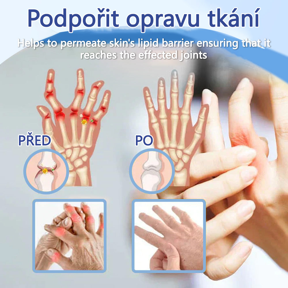 ✅ Oficiální krém s magnéziem Ourlyard® – úleva od bolesti kloubů, svalů a nervů (doporučeno Mayo Clinic)