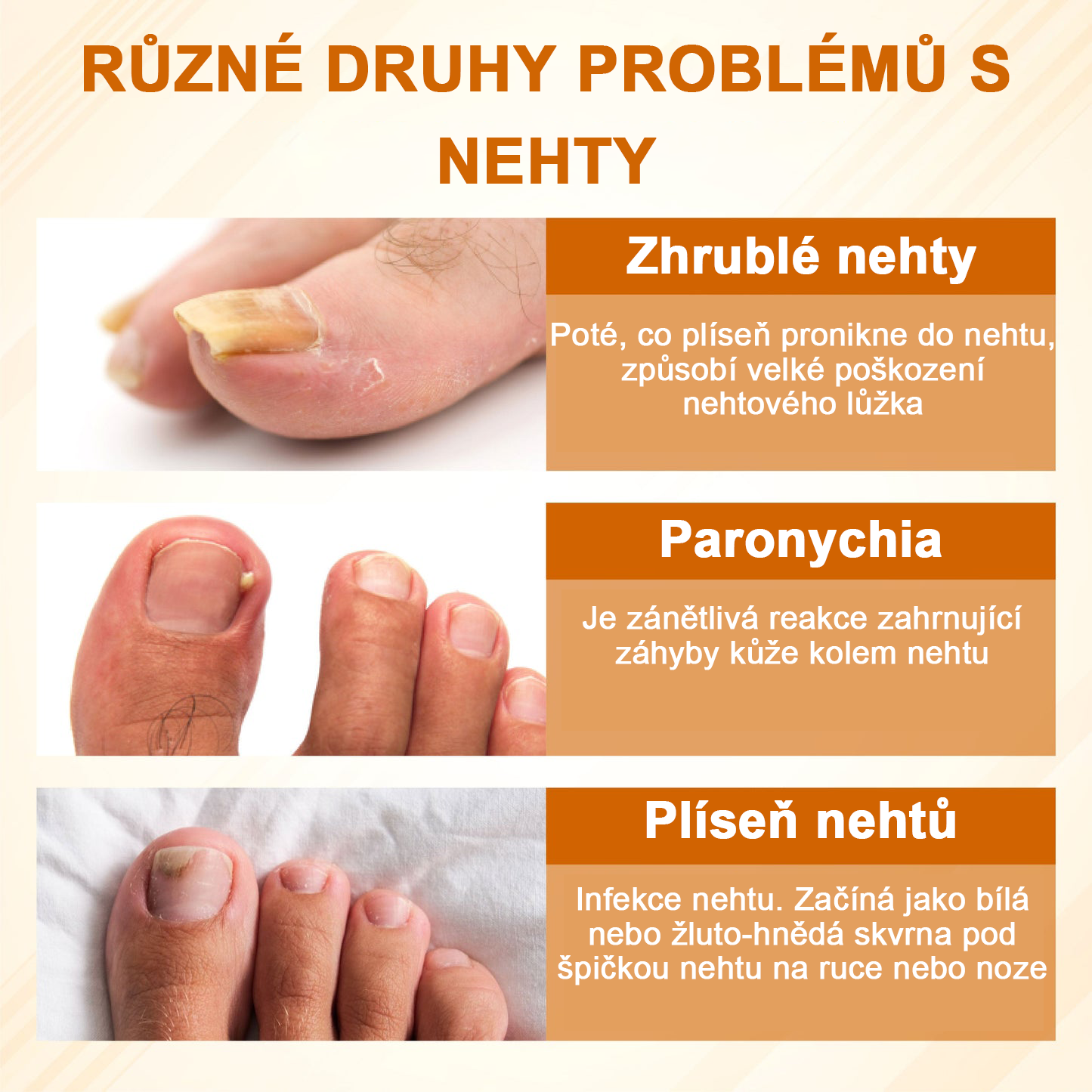 ATTDX® Fungiclear Sprej na nehty s včelí terapií✨✨