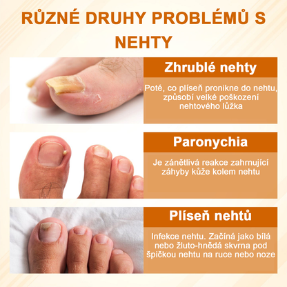 ATTDX® Fungiclear Sprej na nehty s včelí terapií✨✨
