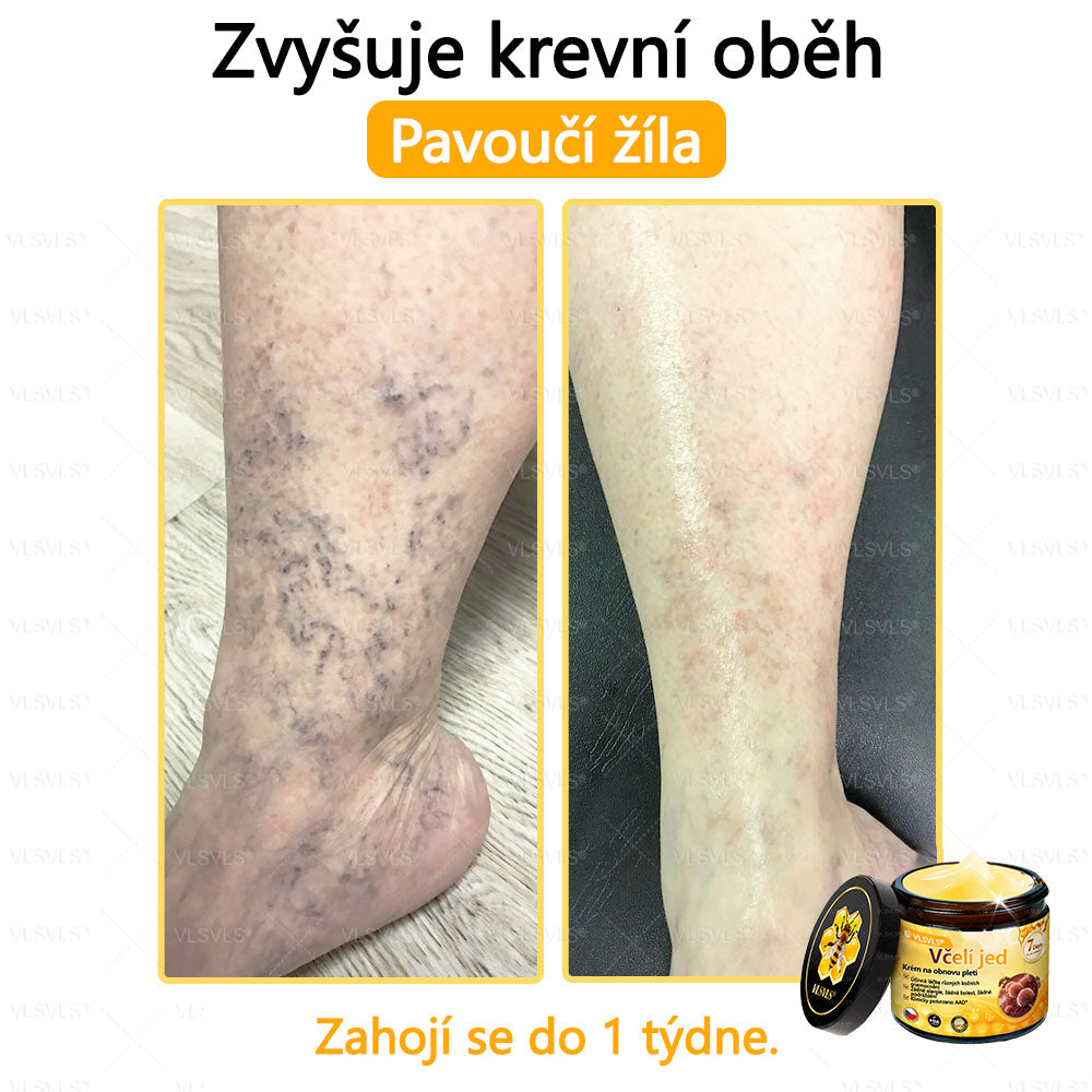 Žhavý výprodej🎉 Obnovující krém se včelím jedem🐝