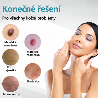 Foulme® Laserové pero na bradavice a znaménka🔦🔦 - neinvazivní a bezbolestné