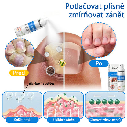✅Zvoevo® Magnesium bylinný sprej ⚕️ Certifikace MHRA – úleva při psoriáze, ekzému, intimních bakteriálních infekcích, akné a tmavých skvrnách✨