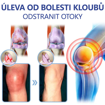 ✅ Oficiální krém s magnéziem Ourlyard® – úleva od bolesti kloubů, svalů a nervů (doporučeno Mayo Clinic)